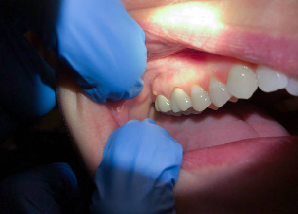Best Urgent Tooth Repair  in Cave City, AR